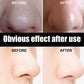 Unisex Blackhead Remove Mask Peel Nasal Strips Deep Shrink Cleansing Pore Nose Black Head Remove Stickers Skin Care Mask Patch