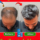 The most effective hair growth essential oil in 2024. Experts authoritatively certified,effective in repairing baldness and hair