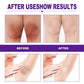 Private Body Whitening Cream Armpit Buttock Nipple Private Area Pink Essence To Remove Melanin Brighten Beauty Care Melanin