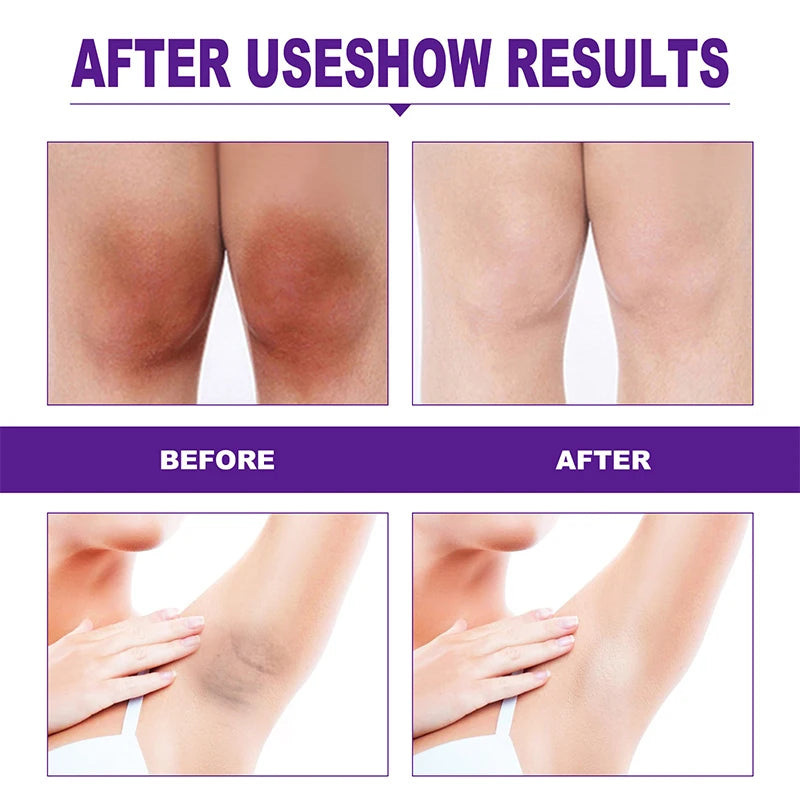 Private Body Whitening Cream Armpit Buttock Nipple Private Area Pink Essence To Remove Melanin Brighten Beauty Care Melanin