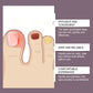 Nail repair blue light, nail care tools