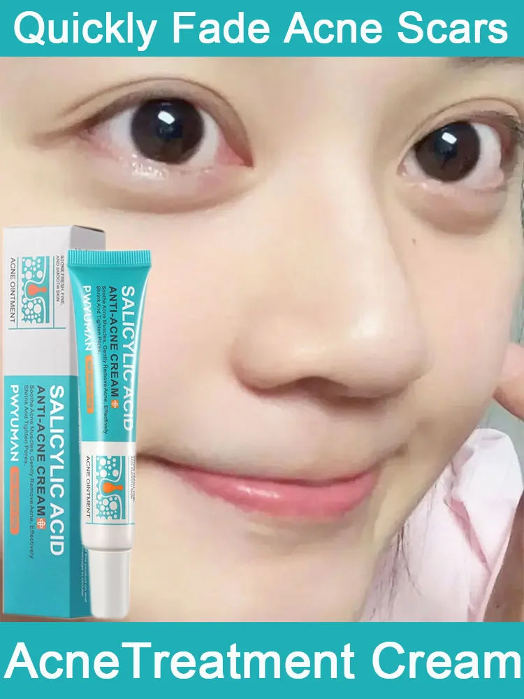 Salicylic Acid Acne Treatment Cream Repair Pimple Spots Deep Cleaning Pore Shrinking Anti-acne Oil Control Moisturizer Skin Care