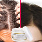 Fast Anti Exfoliating Scrub Remove Dandruff Anti Itching Treatment Seborrheic Scalp Oil Control Cleansing Repair Scalp Care 50g