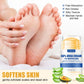 40g Ultra-Hydrating 60% Urea Foot Cream Aloe Vera for Softening Dry Cracked Feet - Gentle Exfoliation Daily Foot Care Solution