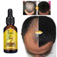Ginger Hair Care Oil Hair Roots Scalp Treatment Improve Androgenetic Alopecia Scalp Treatment Serum Strengthen Hair Roots