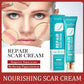 NEW SADOER Scar Repair Cream Repairing Scald Moisturizing Rejuvenating Hydrating Firming Face Cream Facial Skin Care Products