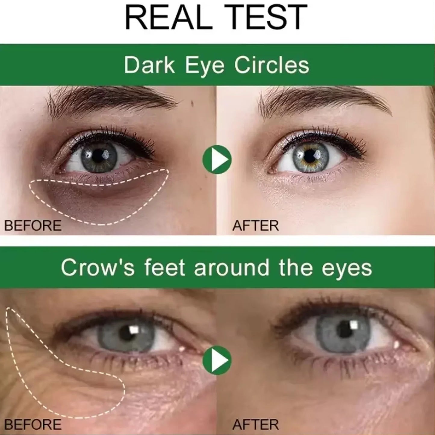 7 Day Tighten Smooth Wrinkles Eye Cream Korean Fade Eye Fine Line Dark Circles Bags Puffiness Tighten Under Eyes Women Skin Care