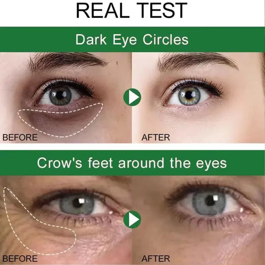 7 Day Tighten Smooth Wrinkles Eye Cream Korean Fade Eye Fine Line Dark Circles Bags Puffiness Tighten Under Eyes Women Skin Care