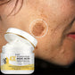 Kojic Acid Face Cream, Evens Out Skin Tone, Eliminates Dark Spots and Dullness - Non-Greasy, Suitable for Both Men and Women - Whitening and Moisturizing Cream, for Day and Night Use - 60g