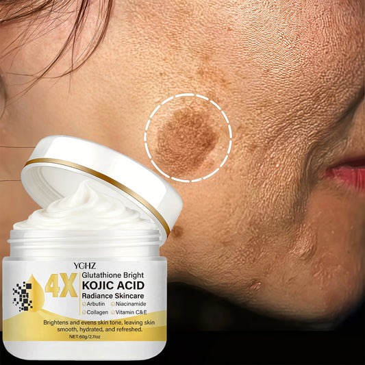 Kojic Acid Face Cream, Evens Out Skin Tone, Eliminates Dark Spots and Dullness - Non-Greasy, Suitable for Both Men and Women - Whitening and Moisturizing Cream, for Day and Night Use - 60g