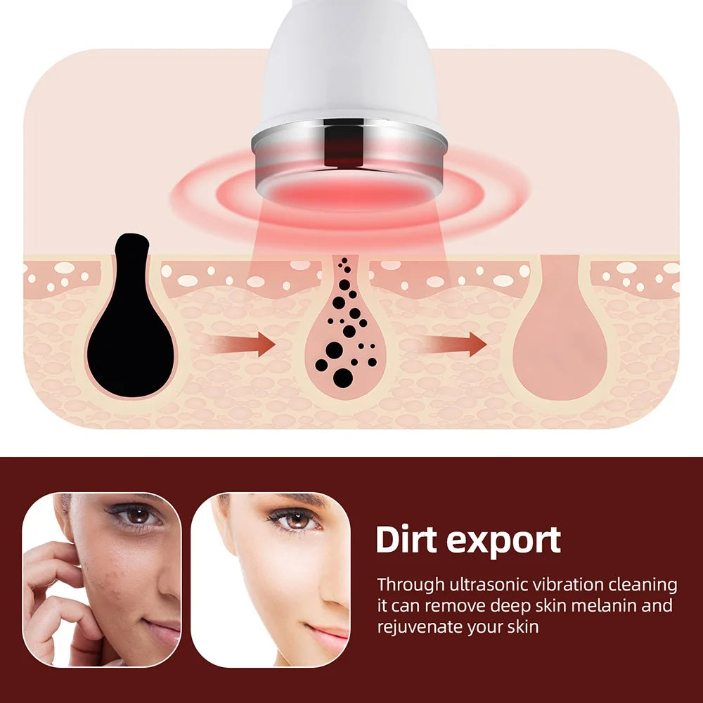 Ultrasound Skin Care Beauty Machine Skin Anti Aging High Frequency Face Eye Massager Ultrasonic Beauty Women SPA Device