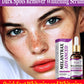 Dark Spots Remover Whitening Serum Face Freckle Melanin Correcting Anti Pigmentation Brighten Beauty Korean Day Night Skin Care