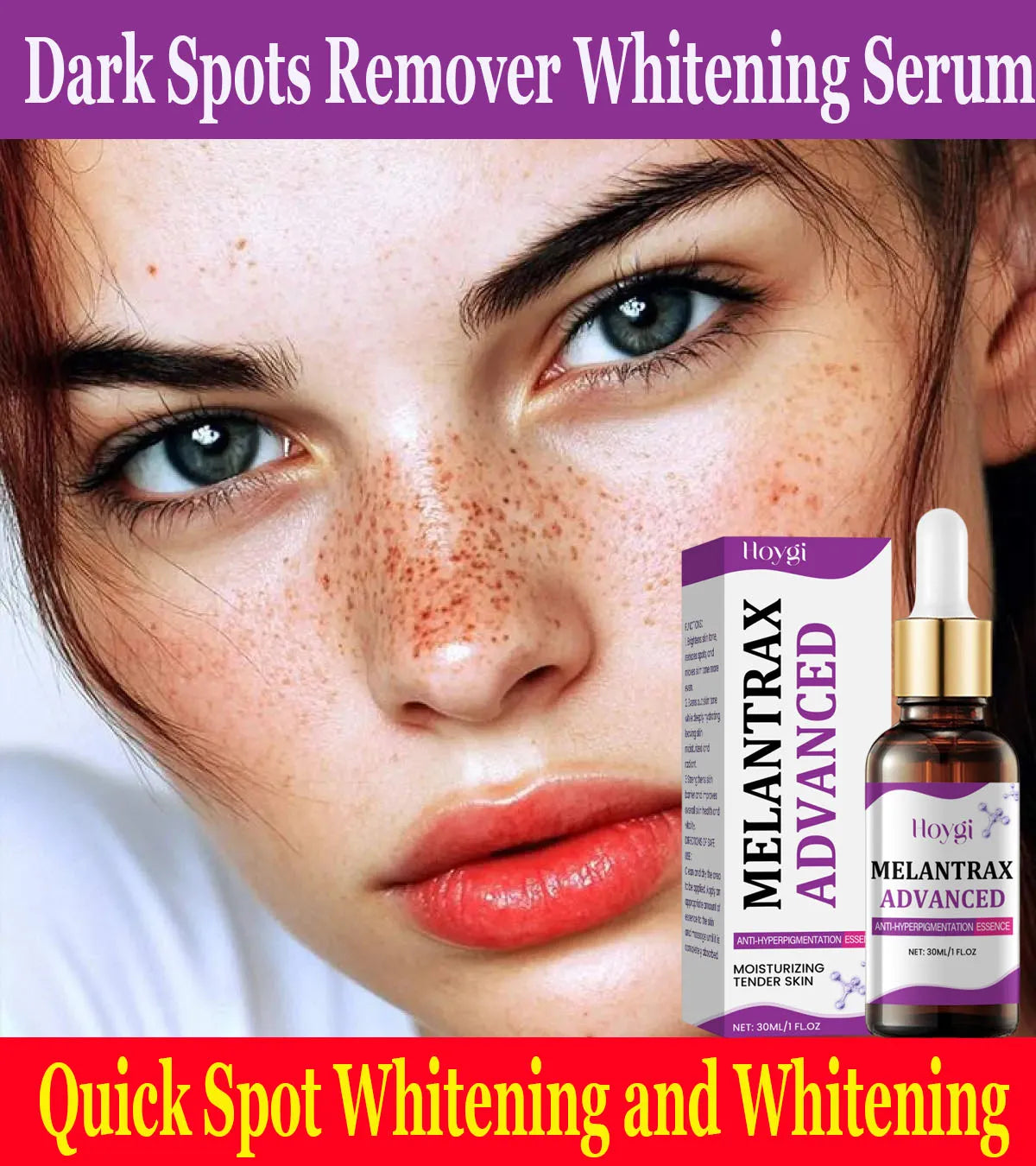 Dark Spots Remover Whitening Serum Face Freckle Melanin Correcting Anti Pigmentation Brighten Beauty Korean Day Night Skin Care