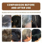 Gray White Hair Treatment Serum Cover White Hair To Black Natural Color Repair Spray Anti Loss Hair Restore Healthy Hair Care