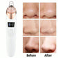 Electric Blackhead Remover Pore Vacuum Acne Cleaner