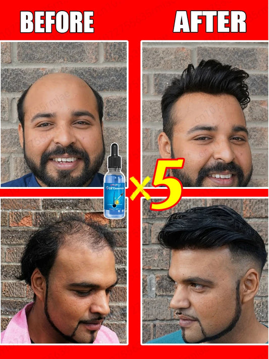 If you are suffering from hair loss and baldness, don’t miss this product.