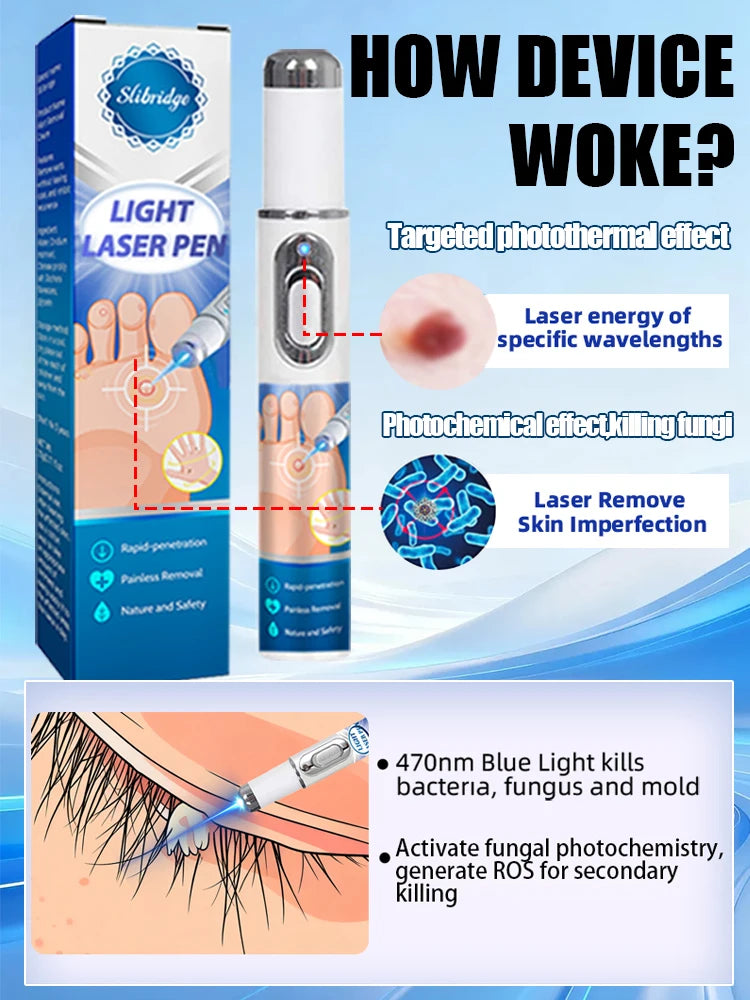 Wart removal pen, skin tag removal pen, suitable for use on the face, neck, hands, and feet.