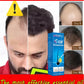 If you are suffering from hair loss and baldness, don’t miss this product.