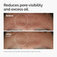 30ml of 10% Niacinamide+1% Zinc, Suitable for Smooth Serum on Skin Prone To Problems, Suitable for Both Men and Women