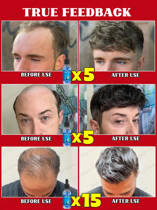 No longer worry about baldness, you will grow thick hair by using this product