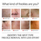 Dark Spots Removal Cream Facial Whitening Freckle Acne Mark Pigmentation Removal Melanin Skin Correction Brighten Care Products