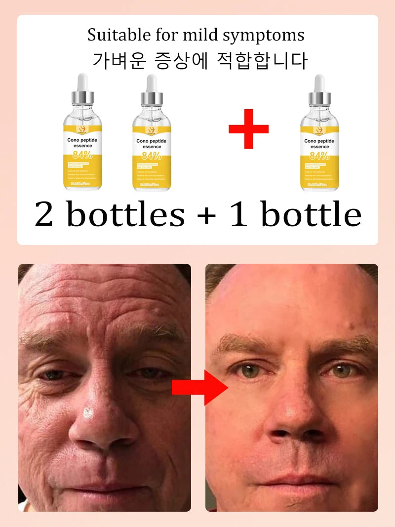 NO Wrinkle, 20 years younger.full body face.More discounts on packages