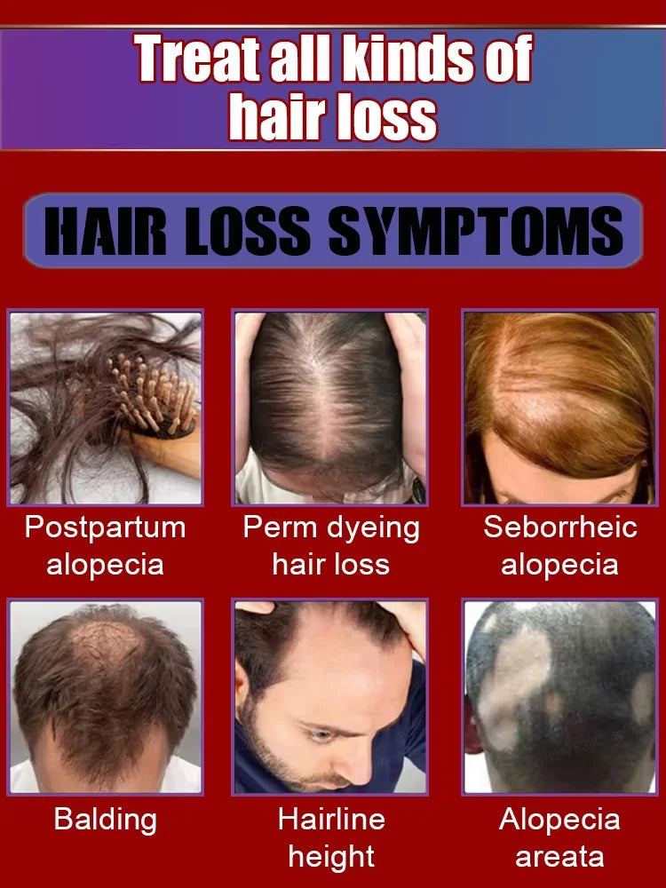No longer worry about baldness, you will grow thick hair by using this product