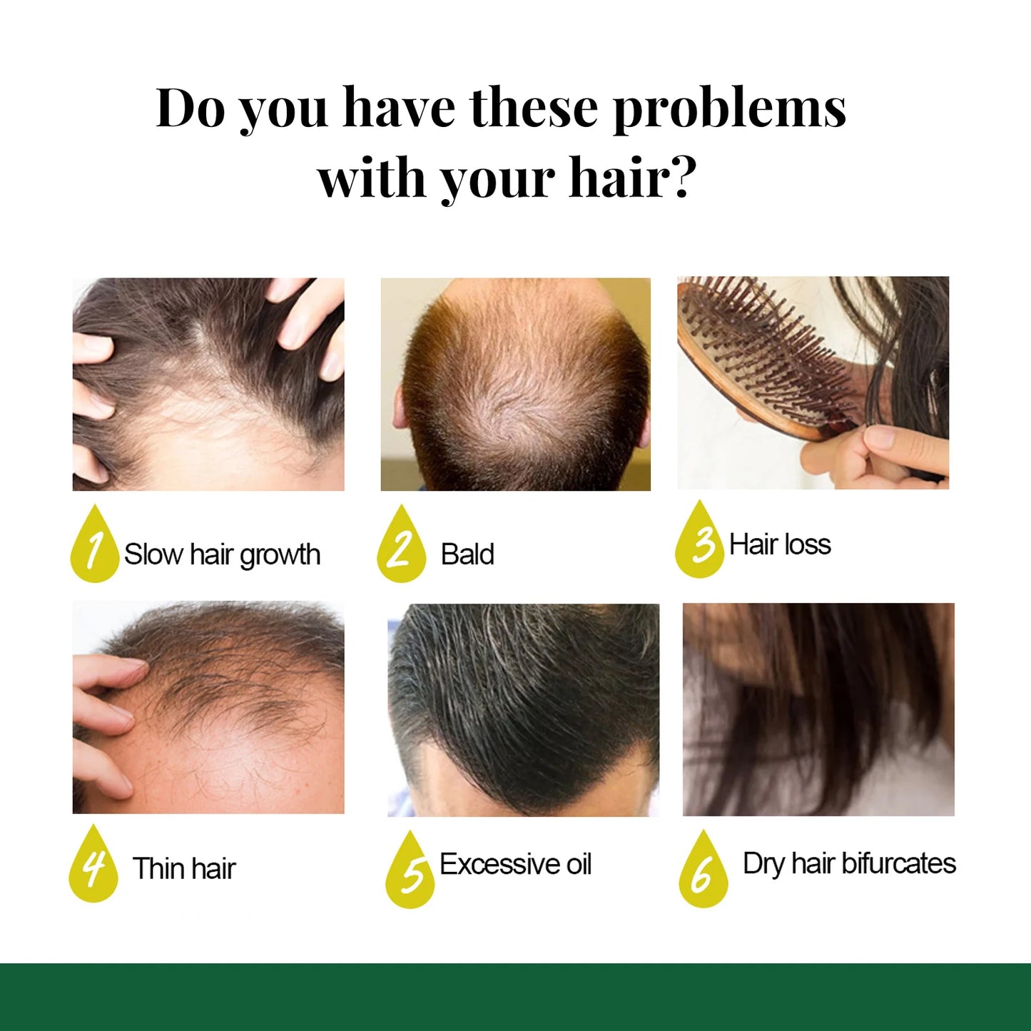 Ginger Care Hair Spray Hair Growth Essence Nourish Hair Roots Massag Scalp Repair Hair Quality Control Oil Hair Care Solution
