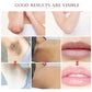 Whitening Cream For Dark Skin Underarm Bleaching Armpit Lightening And Intimate Area Woman Moisturizer Korean Skin Care Products