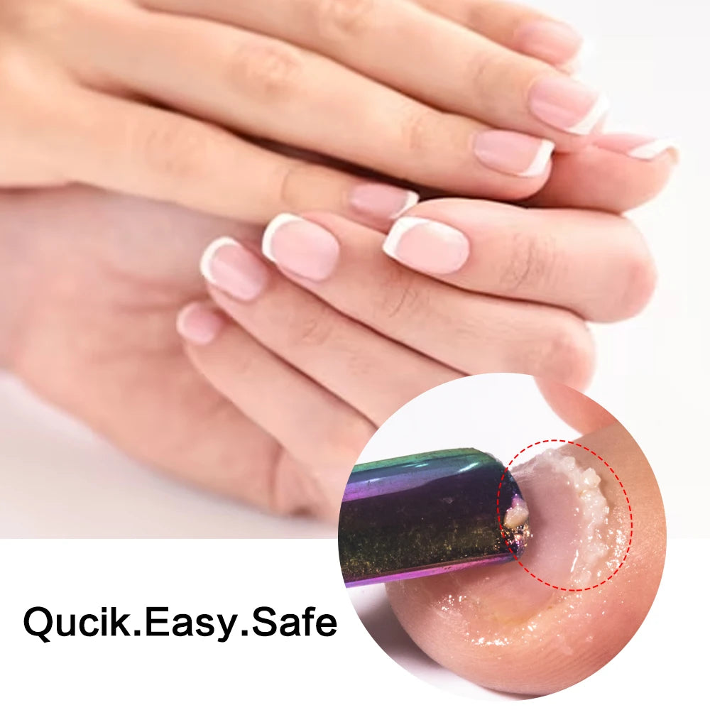 KODIES GEL Cuticle Remover 15ML Gentle Exfoliator Foot Cuticle Oil Softener Liquid Nail Art Treatment Manicure Repair Care Tools