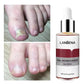 LANBENA Fungus Care Remove Onychomycosis Toes Nourish Brighten Hands Feet Product Repair Suitable Women Nail Pepair Essencs