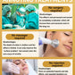 NO Wrinkle, 20 years younger.full body face.More discounts on packages
