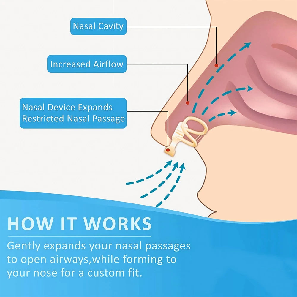 Snore Stopper Nasal Dilator for Snore Reduction Increases Airflow Anti Snoring Devices Silicone Nose Clip Improve Sleep&Snoring