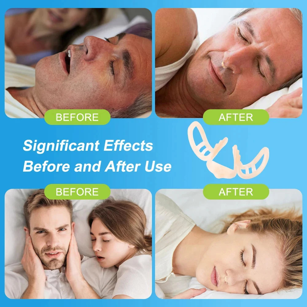 Snore Stopper Nasal Dilator for Snore Reduction Increases Airflow Anti Snoring Devices Silicone Nose Clip Improve Sleep&Snoring
