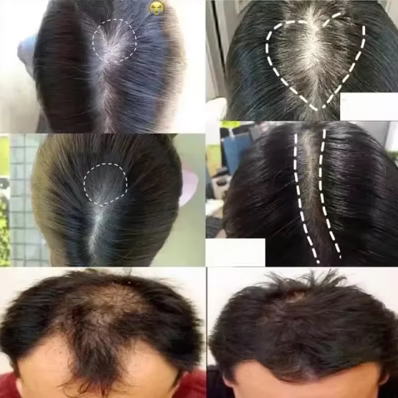 7 Days Fast Batana Oil Hair Growth Serum Anti-loss Hair Regrowth Products Repair Damaged Hair Roots Hair Care For Women Men