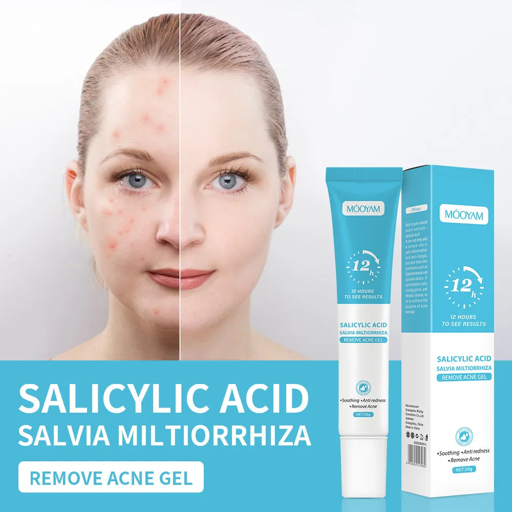 Salicylic Acid Acne Treatment Cream Repair Pimple Spots Deep Cleaning Pore Shrinking Anti-acne Oil Control Moisturizer Skin Care