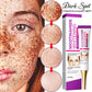 Mild Niacinamide Lightening Melasma Cream Effectively Fade Melanin Bleaching Cream Remove Dark Pigment Moisturizing Skin Care