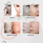 Foreverlily Diamond Facial Peeling Machine Home Use Professional Microdermabrasion Nano Water Spray Exfoliation Beauty Machine