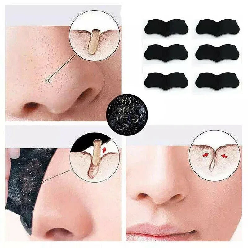 100/50/20/10pcs Bamboo Charcoal Blackhead Remover Black Dots Spots Mask Nose Sticker Cleaner Nose Pore Deep Clean Strip