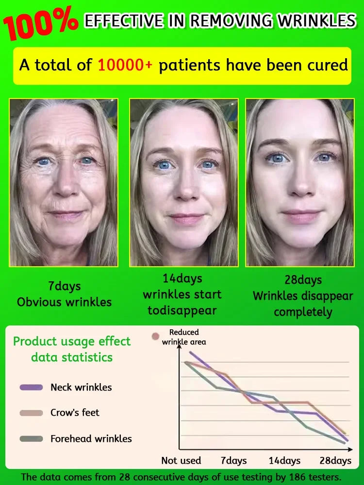Wrinkles disappear permanently