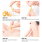 Hyaluronic Acid Capsules Serum Spot Acne Remover Whitening Face Serum Anti-Wrinkle Firming Brighten Skin Care Cosmetics