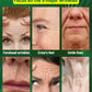 Wrinkles disappear permanently