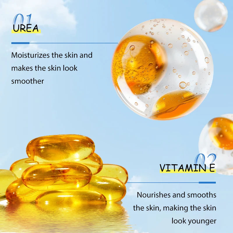 100g Chicken Skin Removal Cream Body Repair Keratosis Pilaris Rough Bumpy Pore Spots Dull Skin Care Whitening Moisturizing