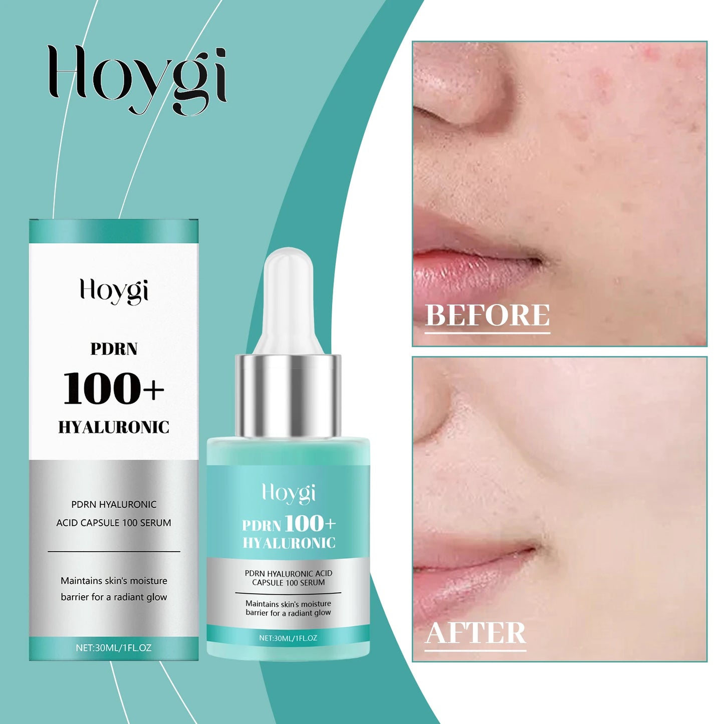 Hoygi 30ml Hyaluronic Acid Hydrating Serum Deep Moisturize Firm Brighten Relieve Dry Skin Boost Elasticity Even Tone Face Essenc