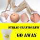 50ml Stretch Mark Repair Cream Powerful Precious Body Scar Postpartum Stretch Marks Obesity Skin Care Remover W1T2