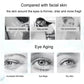 Nicotinamide Eyes Cream Dark Circles Remove Eye Bags Under Eye Hyaluronic Acid Moisturizing Serum Against Puffiness Eye Care Gel