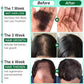 Fast Hair Growth Serum Spray Anti Hair Loss Prevent Baldness Scalp Treatment Repair Roots Beauty Health Hair Care For Men Women