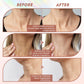 Neck LED Lift Mask Photon Anti-Wrinkle Skin Tightening Neck Beauty Device Skin Brighten Rejuvenation Neck Wrinkle Remover