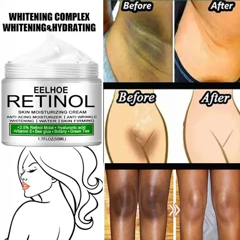 Body Whitening Cream Dark Skin Armpit Lightening Intimate Areas Underarm Bleaching Private Parts Whiten Cream Body Lotion Beauty
