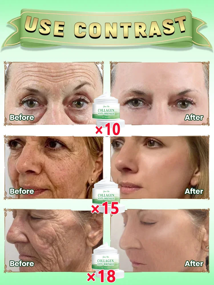 Wrinkles disappear permanently
